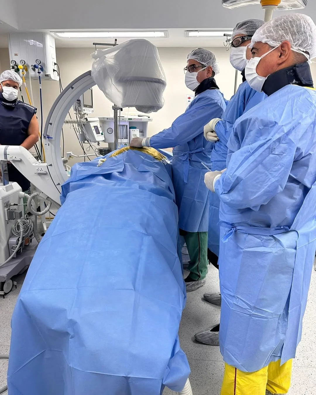 Implantando neuroestimulador para controle de de dor em paciente com 2 cirurgias prévias de coluna lombar. Hospital Memorial São José – Recife, PE. Implantando neuroestimulador para controle de de dor em paciente com 2 cirurgias prévias de coluna lombar. Hospital Memorial São José - Recife, PE.