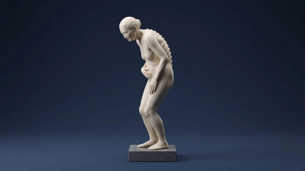 Escultura minimalista de uma figura humana idosa levemente inclinada para frente sobre fundo azul-marinho, simbolizando os desafios relacionados às doenças da coluna e à decisão sobre a cirurgia.