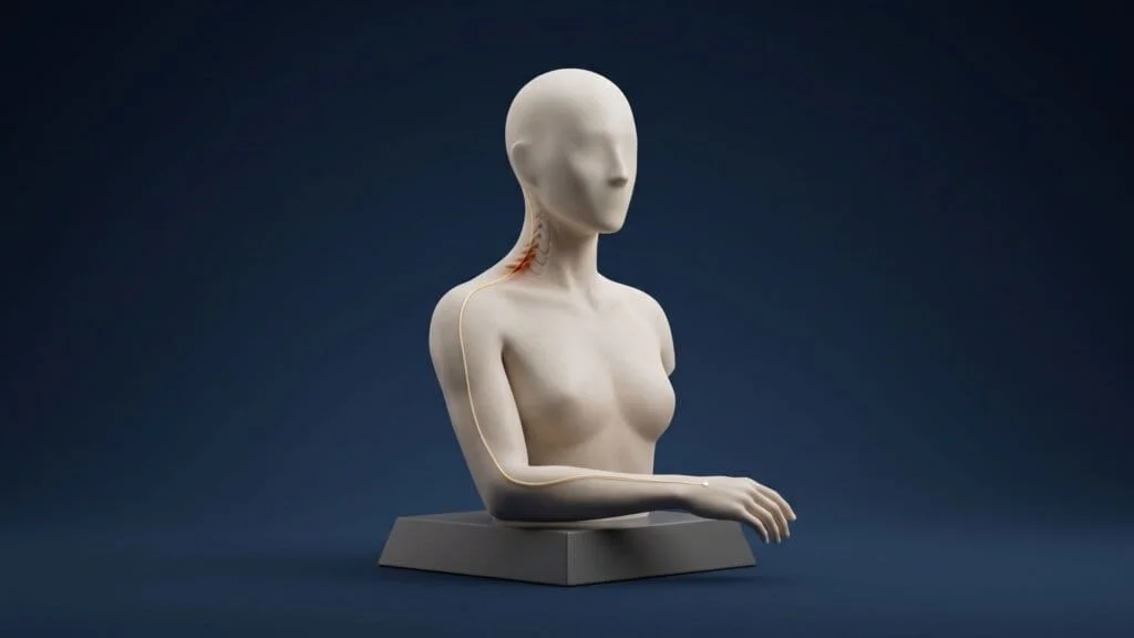 Ilustração 3D minimalista de um busto humano estilizado sobre fundo azul-marinho. A coluna cervical é discretamente visível no pescoço, com um ponto avermelhado indicando compressão nervosa e um fino trajeto dourado representando o nervo que segue do pescoço até a mão, simbolizando a dor irradiada no braço.
